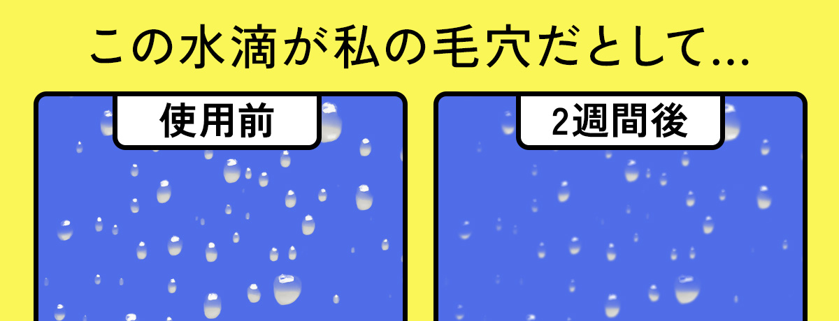 Niacinamide 10% + Zinc 1%の使用効果